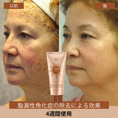 🏵️PuraCure® 美白・スポットケアフェイスマスク【顔・ボディ兼用】天然由来成分配合で、シミ・そばかす・日焼けによるシミを長期間ケア✨