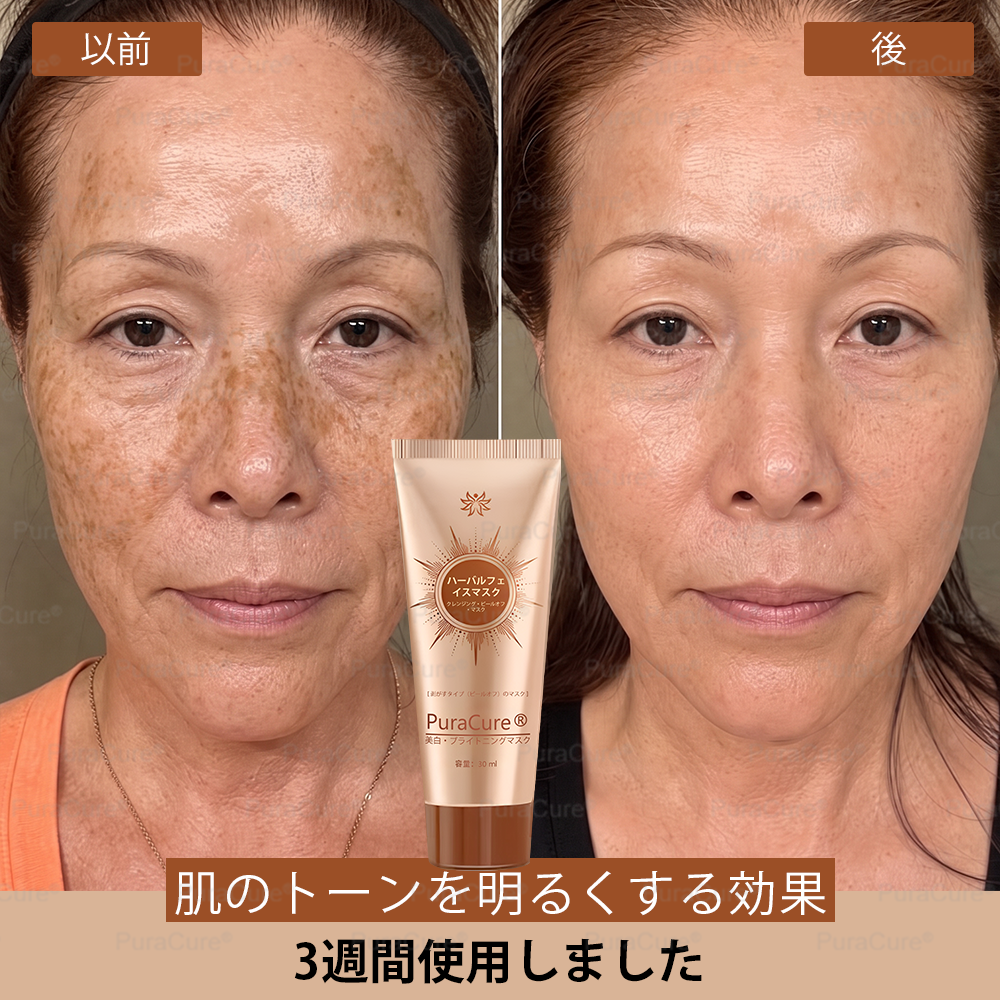 🏵️PuraCure® 美白・スポットケアフェイスマスク【顔・ボディ兼用】天然由来成分配合で、シミ・そばかす・日焼けによるシミを長期間ケア✨