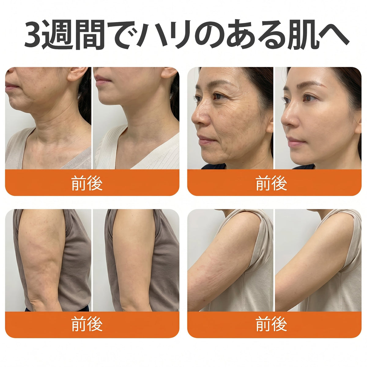 🧑‍⚕️PuraCure® ビーベノム リペア再生クリーム🔥天然由来のエイジングケアで肌を引き締め、ハリを与え、乾燥による小ジワを目立たなくします – 50mL